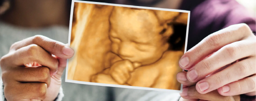 4d baby scan tile image