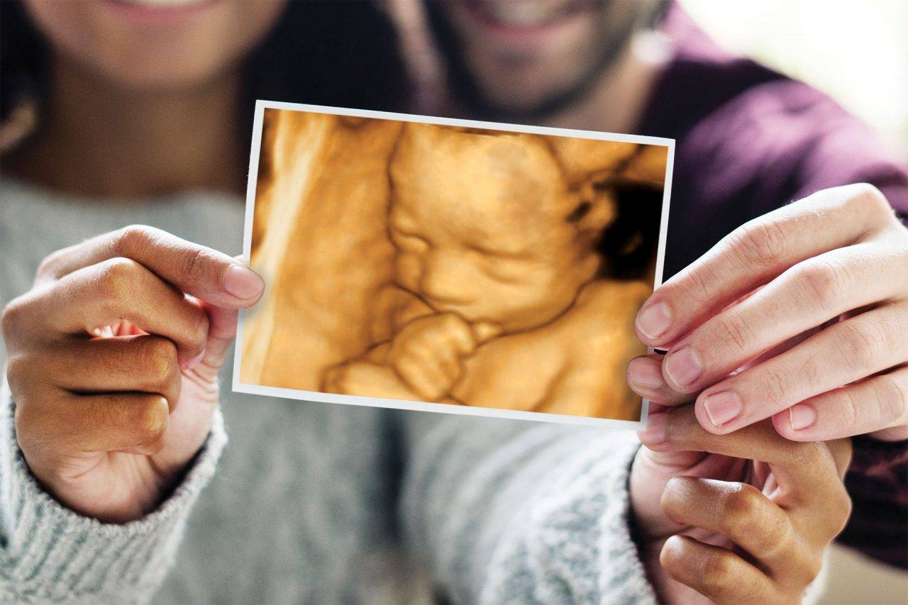 Safety ALARA Guidelines Hey Baby 4D Colchester