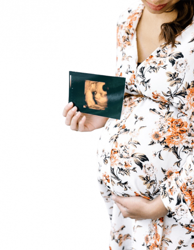 Wellbeing & 4D Baby Scans