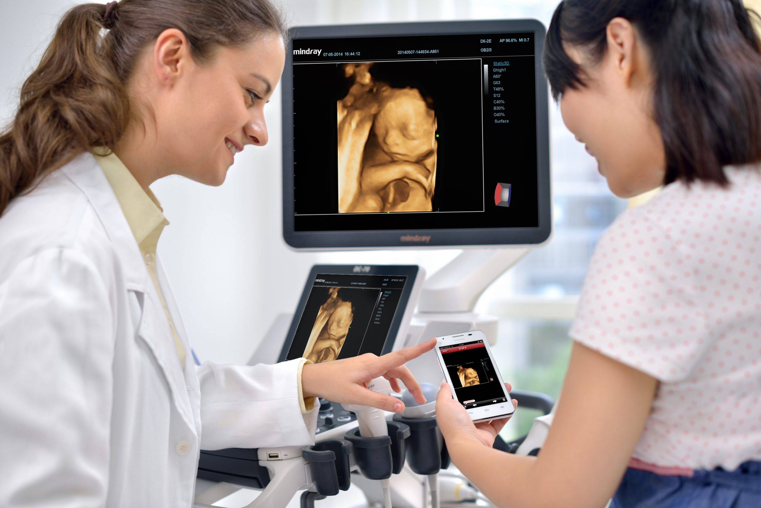 Answers to all of your Hey Baby 4D scan questions