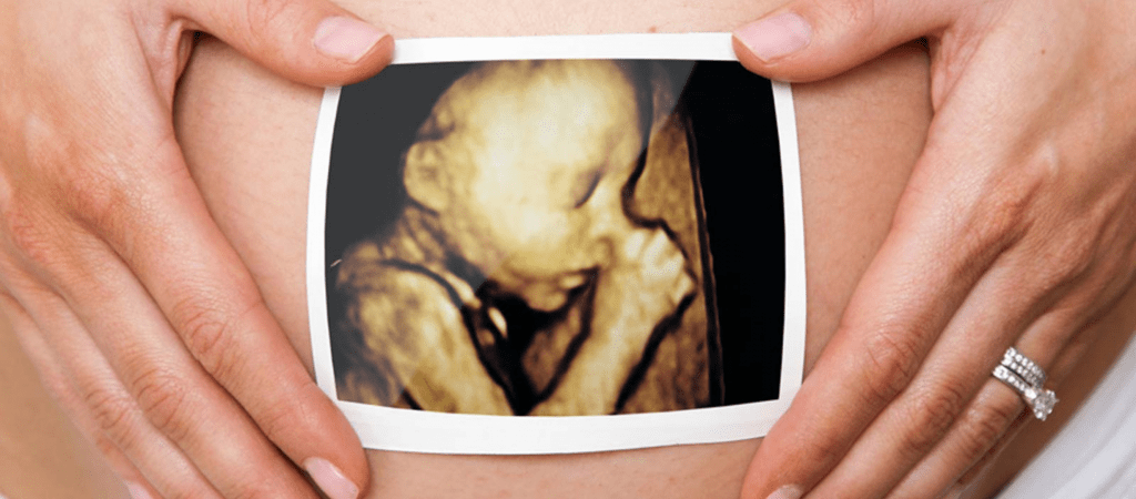 4D Baby Scan | Hey Baby 4D Southend | Scans From £69