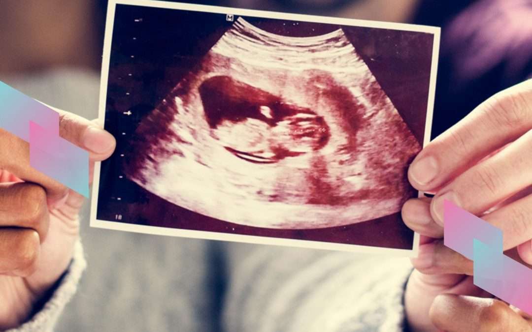 Understanding the Different Types of Baby Scans: A Comprehensive Guide