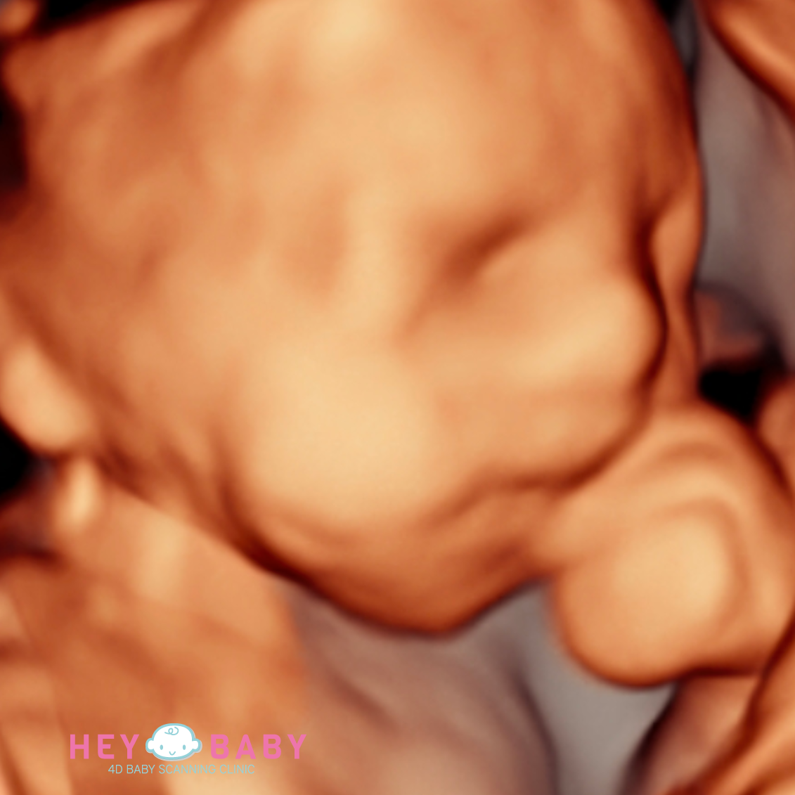 4d scan image wm