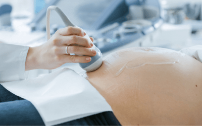 Obstetric Sonographer – Sutton, South London
